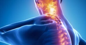 Neuropathic Pain